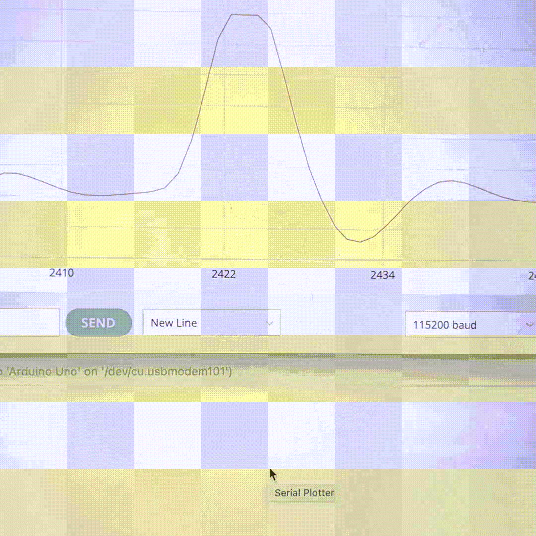 Here I was just playing around with another feature of the heart rate sensor. It can also track my electrocardiography graph, which is what's seen in hospitals.